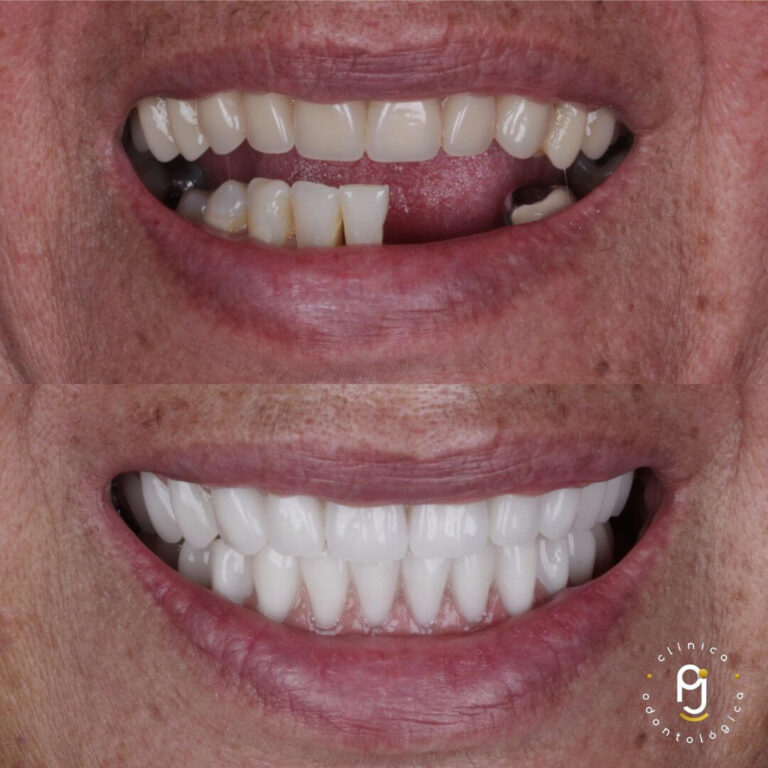 Tratamentos Odontológicos Vila Maria
