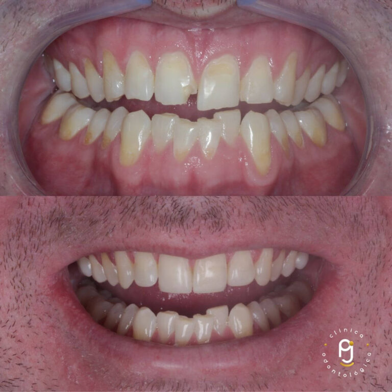 Tratamentos Odontológicos Vila Maria