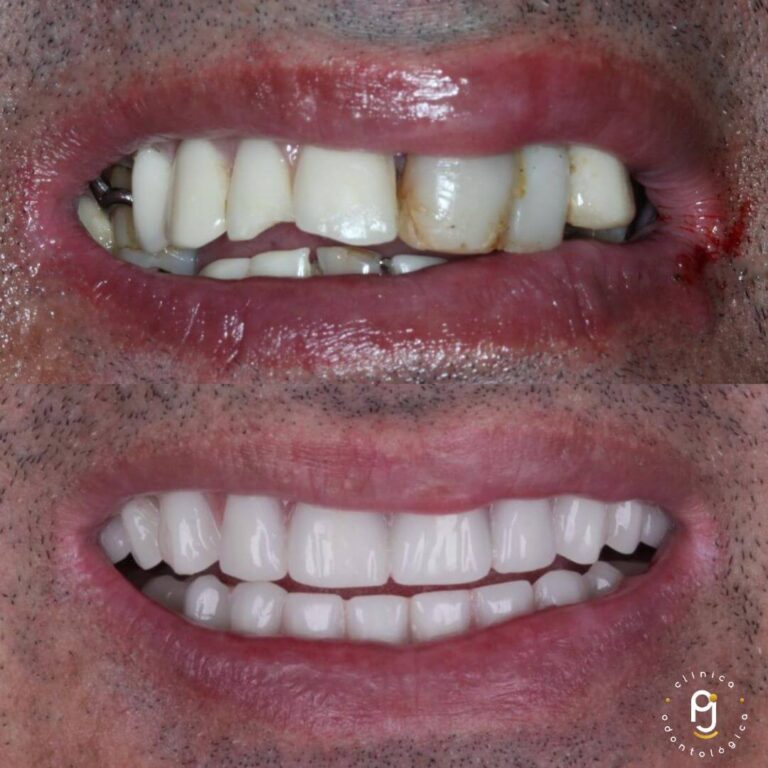 Tratamentos Odontológicos Vila Maria