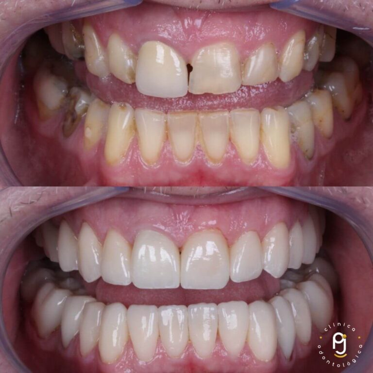 Tratamentos Odontológicos Vila Maria
