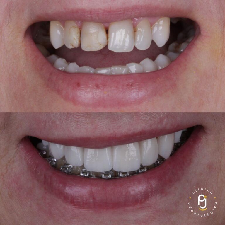 Tratamentos Odontológicos Vila Maria