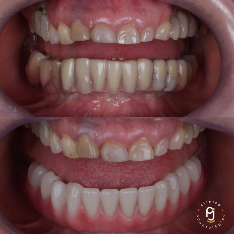 Tratamentos Odontológicos Vila Maria