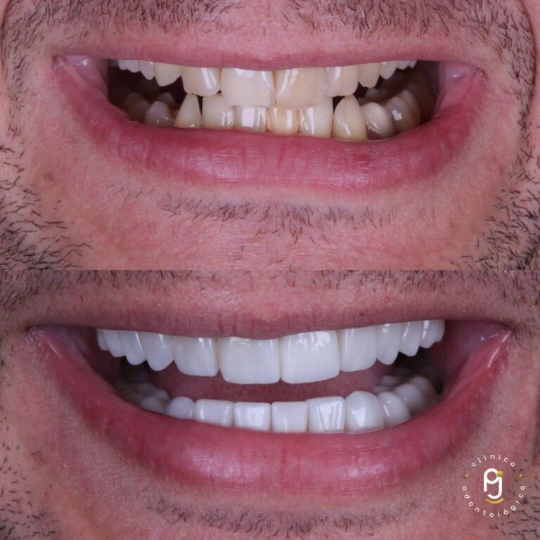 Tratamentos Odontológicos Vila Maria