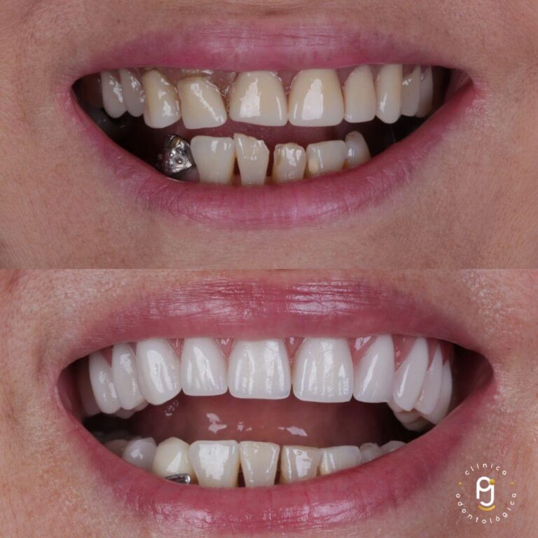 Tratamentos Odontológicos Vila Maria