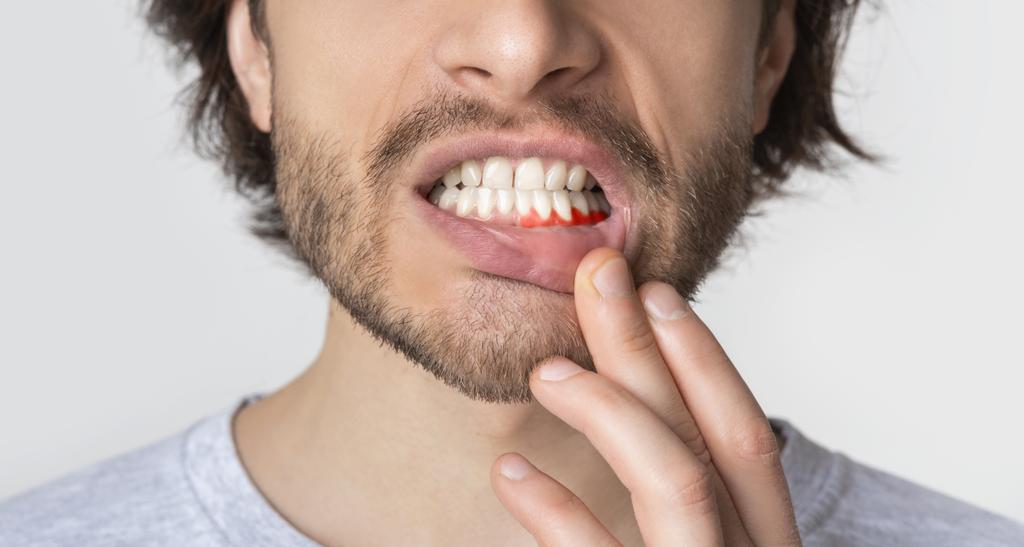 Periodontia Tratamento de Gengiva Vila Maria