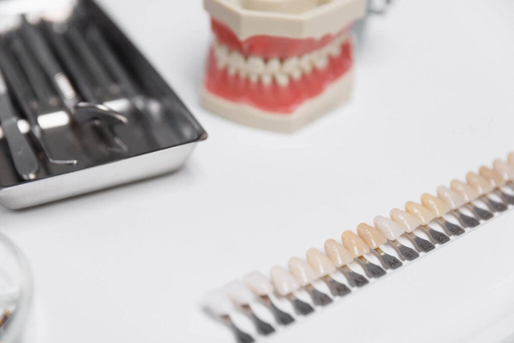 Clareamento dental: laser ou moldeira